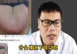 舌诊医案