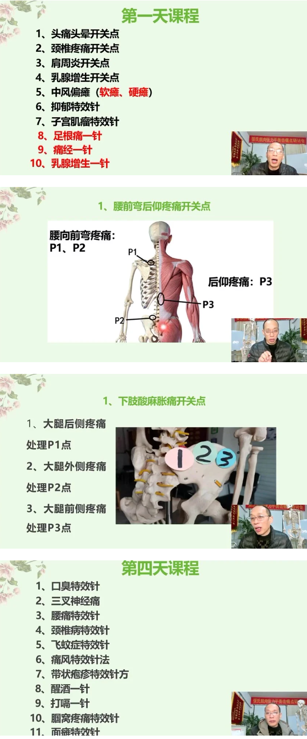 张文雨---疼痛开关特效绝技  第2张