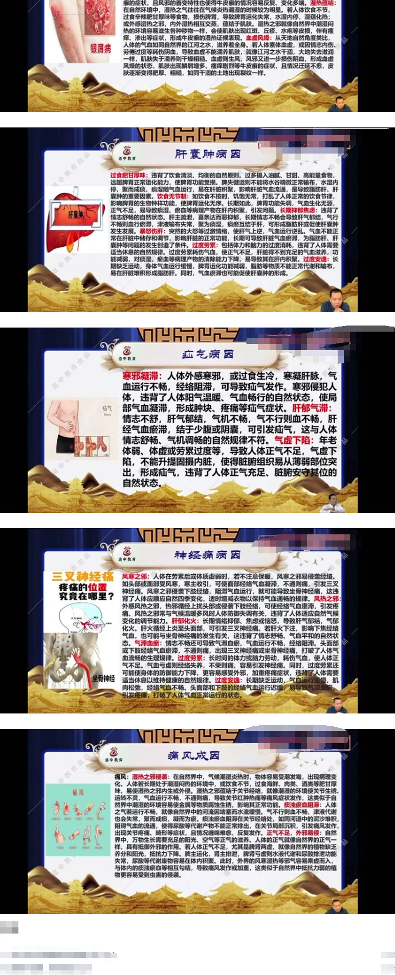 《道祖一消三愈针法》视频38集  第2张