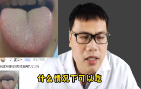 舌诊医案 第1张 舌诊医案 第1张