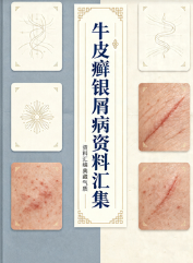 牛皮癣银屑病资料汇集pdf 第1张 牛皮癣银屑病资料汇集pdf 第1张