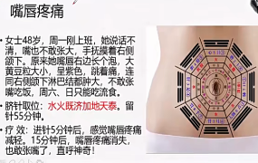 齐永2022年八卦脐针脐诊111讲临床提升精品推广班 第1张 齐永2022年八卦脐针脐诊111讲临床提升精品推广班 第1张